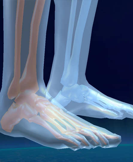 Orthotic Care - Cascade Orthotics Calgary